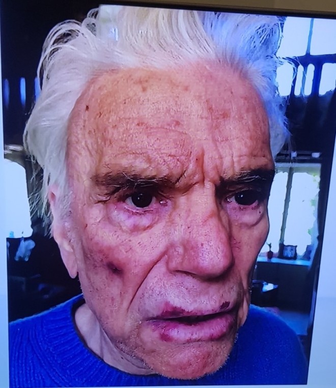 Μπερνάρ Ταπί