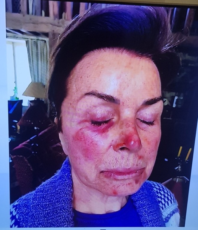 Μπερνάρ Ταπί ληστεία